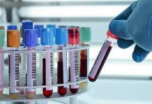 Laboratório do CHMT testa colheitas da Região de Lisboa