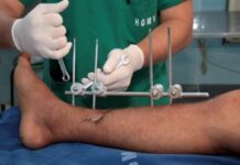 Entroncamento | CHMT contratualiza 80 cirurgias à Santa Casa da Misericórdia