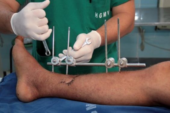 cirurgia ortopédica